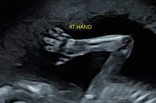 Bébé fait coucou à l'échographie